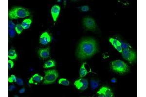 Image no. 3 for anti-Lysyl Oxidase (LOX) (AA 22-168) antibody (ABIN1491218) (LOX 抗体  (AA 22-168))