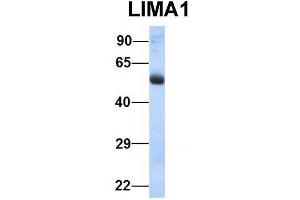 Host:  Rabbit  Target Name:  LIMA1  Sample Type:  Human Fetal Lung  Antibody Dilution:  1. (LIMA1 抗体  (N-Term))