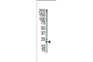 The anti-Bim BH3 domain Pab (ABIN388101 and ABIN2846193) is used in Western blot to detect Bim BH3 in HL-60 cell lysate. (BIM 抗体  (AA 130-165))