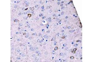 IHC analysis of SCRN1 using anti-SCRN1 antibody (ABIN7602923). (Secernin 1 抗体  (C-Term))