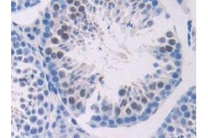 Detection of ADCY6 in Mouse Testis Tissue using Polyclonal Antibody to Adenylate Cyclase 6 (ADCY6)