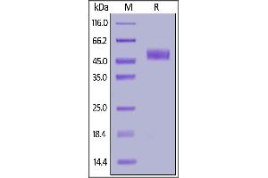 SDS-PAGE (SDS) image for Inducible T-Cell Co-Stimulator (ICOS) (AA 21-144) (Active) protein (Fc Tag) (ABIN6938860)