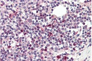 ABIN334506 (5µg/ml) staining of paraffin embedded Human Spleen. (TFEC 抗体  (Internal Region))