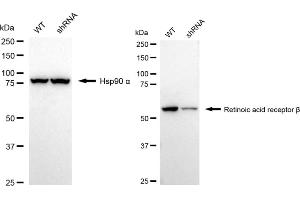 Western blotting analysis using Retinoic Acid Receptor beta antibody (ABIN7800190). (Recombinant Retinoic Acid Receptor beta 抗体)
