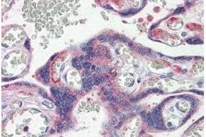 Human Placenta: Formalin-Fixed, Paraffin-Embedded (FFPE) (Claudin 6 抗体  (Val118))
