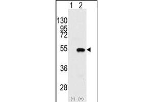 Western blot analysis of SYMD2 (arrow) using rabbit polyclonal SYMD2 Antibody (N-term) (ABIN387897 and ABIN2844146). (SMYD2A 抗体  (N-Term))