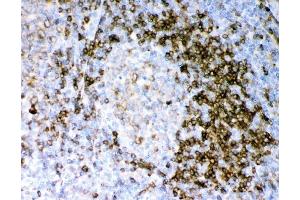IHC analysis of CD79A using anti-CD79A antibody (ABIN3043397). (CD79a 抗体  (AA 121-226))