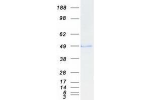 Transforming Growth Factor beta 1 Induced Transcript 1 (TGFB1I1) (Transcript Variant 2) protein (Myc-DYKDDDDK Tag)