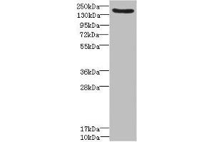 Western blot All lanes: LY75 antibody IgG at 1. (LY75/DEC-205 抗体  (AA 440-680))