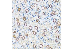 Immunohistochemistry of paraffin-embedded mouse kidney using  antibody (ABIN7265652) at dilution of 1:100 (40x lens). (AQP2 抗体  (AA 147-271))
