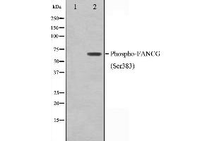 Western blot analysis on K562 cell lysate using Phospho-FANCG(Ser383) Antibody,The lane on the left is treated with the antigen-specific peptide. (FANCG 抗体  (pSer383))