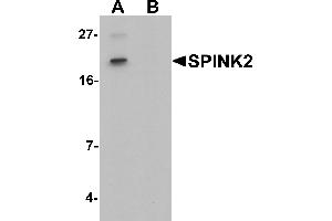 Western blot analysis of SPINK2 in mouse heart tissue lysate with SPINK2 antibody at 1 µg/mL in (A) the absence and (B) the presence of blocking peptide. (SPINK2 抗体  (C-Term))