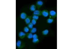IF analysis of Neurofibromin/NF1 using anti-Neurofibromin/NF1 antibody (ABIN7600197). (Neurofibromin 1 抗体  (AA 160-270))