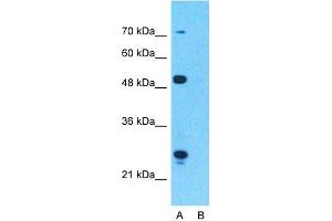 Western Blotting (WB) image for anti-Carnitine Palmitoyltransferase 1A (Liver) (CPT1A) (Middle Region) antibody (ABIN2782010)