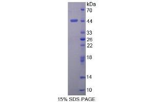 SDS-PAGE analysis of Human DHPS Protein. (DHPS 蛋白)