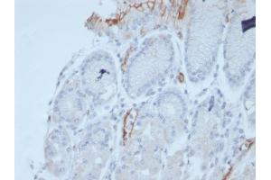 Formalin-fixed, paraffin-embedded human stomach stained with MUC2 Recombinant Mouse Monoclonal Antibody (rMLP/842). (Recombinant MUC2 抗体)