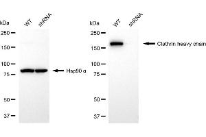 Western blotting analysis using clathrin heavy chain antibody (ABIN7798091). (Recombinant Clathrin Heavy Chain (CLTC) 抗体)