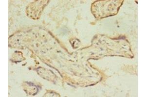 Immunohistochemistry of paraffin-embedded human placenta tissue using ABIN7158507 at dilution of 1:100 (ACSL4 抗体  (AA 457-670))