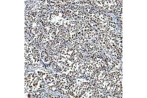 IHC analysis of SF3A3 using anti-SF3A3 antibody (ABIN7599863).