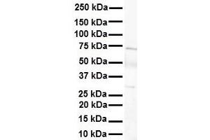 WB Suggested Anti-LBX1 antibody Titration: 1 ug/mL Sample Type: Human heart (Lbx1 抗体  (Middle Region))