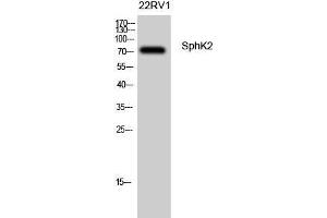 Western Blot (WB) analysis of 22RV1 cells using SphK2 Polyclonal Antibody. (SPHK2 抗体  (Tyr754))