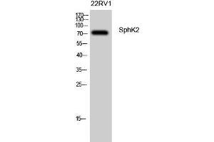 Western Blot (WB) analysis of 22RV1 cells using SphK2 Polyclonal Antibody.