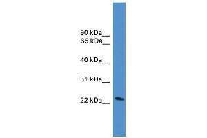 DGAT2L7 antibody used at 0. (DGAT2L7P 抗体  (C-Term))