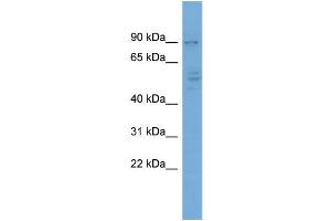 WB Suggested Anti-CDH4  Antibody Titration: 0. (Cadherin 4 抗体  (Middle Region))