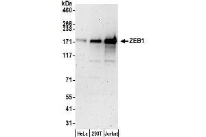 Western Blotting (WB) image for anti-Zinc Finger E-Box Binding Homeobox 1 (ZEB1) (AA 850-900) antibody (ABIN7452186)