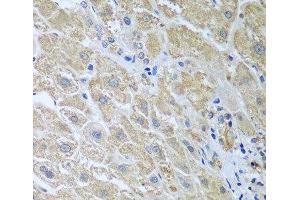 Immunohistochemistry of paraffin-embedded Human liver using WDR48 Polyclonal Antibody at dilution of 1:100 (40x lens). (WDR48 抗体)