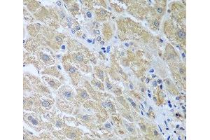Immunohistochemistry of paraffin-embedded Human liver using WDR48 Polyclonal Antibody at dilution of 1:100 (40x lens).