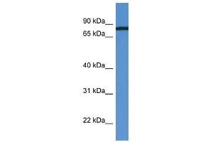 HHIPL1 antibody used at 0. (HHIPL1 抗体  (C-Term))