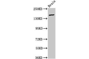Western Blot Positive WB detected in: Rat brain tissue All lanes: ADGRB2 antibody at 3. (BAI2 抗体  (AA 1371-1545))