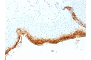 Formalin-fixed, paraffin-embedded human Skin stained with Filaggrin Mouse Recombinant Monoclonal Antibody (rFLG/1561). (Recombinant Filaggrin 抗体  (AA 198-288))