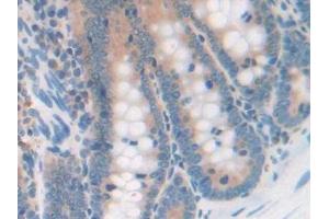 Immunohistochemistry (IHC) image for anti-serpin Peptidase Inhibitor, Clade A (Alpha-1 Antiproteinase, Antitrypsin), Member 10 (SERPINA10) (AA 278-425) antibody (ABIN7438085)