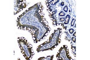 IHC analysis of CIC using anti-CIC antibody (ABIN6719536). (CIC 抗体  (AA 1433-1527))