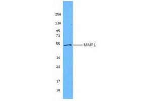Image no. 1 for anti-Matrix Metallopeptidase 1 (Interstitial Collagenase) (MMP1) antibody (ABIN205496) (MMP1 抗体)