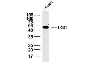 Mouse heart lysates probed with GI1 Polyclonal Antibody, unconjugated  at 1:300 overnight at 4°C followed by a conjugated secondary antibody for 60 minutes at 37°C. (LGI1 抗体  (AA 451-557))