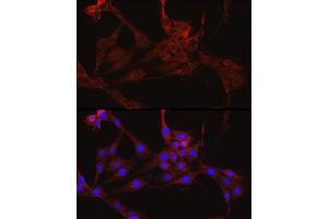 Immunofluorescence (IF) image for anti-Isocitrate Dehydrogenase 1 (NADP+), Soluble (IDH1) (AA 1-414) antibody (ABIN3023106)