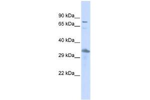 WB Suggested Anti-TEF Antibody Titration:  0. (TEF 抗体  (Middle Region))