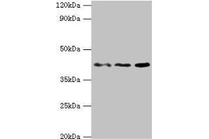 Western blot All lanes: MICA antibody at 8 μg/mL Lane 1: MCF-7 whole cell lysate Lane 2: A431 whole cell lysate Lane 3: Mouse Stomach tissue Secondary Goat polyclonal to rabbit IgG at 1/10000 dilution Predicted band size: 43, 32 kDa Observed band size: 43 kDa (MICA 抗体  (AA 24-307))