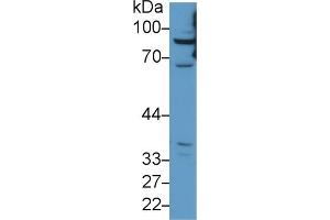 Western Blotting (WB) image for anti-Carnitine Palmitoyltransferase 1A (Liver) (CPT1A) (AA 191-353) antibody (ABIN7436006)