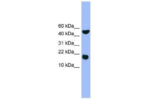 WB Suggested Anti-RWDD1 Antibody Titration: 0. (RWDD1 抗体  (Middle Region))