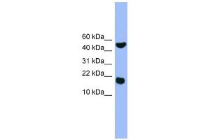 WB Suggested Anti-RWDD1 Antibody Titration: 0.
