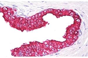 Immunohistochemistry staining of human prostate (paraffin section) using anti-cytokeratin 5/8 (clone C-50). (Keratin 5/8 抗体)