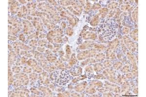 IHC analysis of BHMT using anti-BHMT antibody (ABIN7599940). (BHMT 抗体  (AA 13-386))