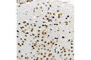 Immunohistochemistry of paraffin embedded mouse brain using UBE3A (ABIN7076104) at dilution of 1:1000 (400x lens) (ube3a 抗体)