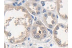 Detection of NSF in Human Kidney Tissue using Polyclonal Antibody to N-Ethylmaleimide Sensitive Factor (NSF) (NSF 抗体  (AA 590-744))