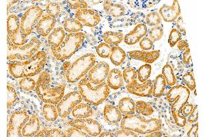 ABIN6261525 and ABIN6272578 at 1/100 staining Rat kidney tissue by IHC-P.