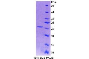 SDS-PAGE analysis of Rat vHL Protein. (VHL 蛋白)